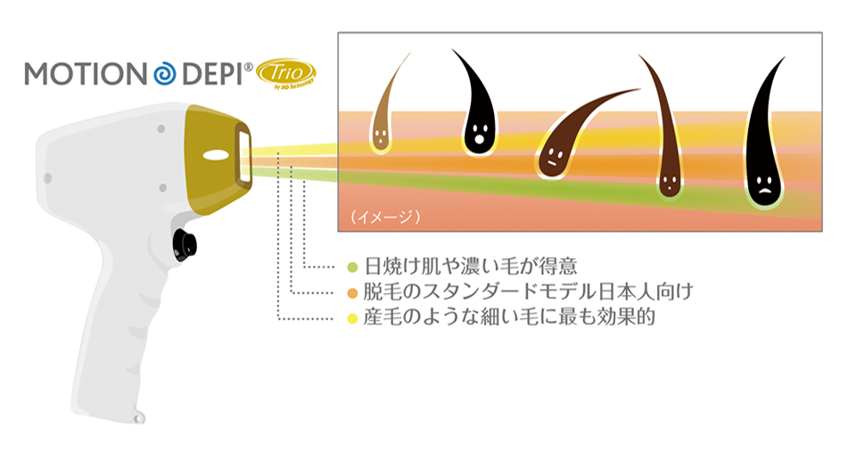 MOTION DEPI Trio